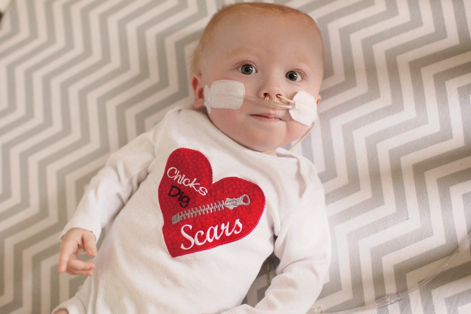 Chicks dig scars
